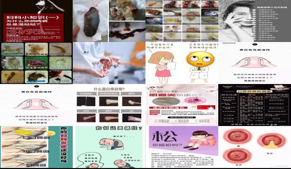 宫颈充血可以同房吗 - 汕头宫颈充血能同房吗