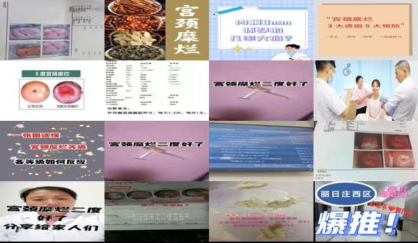 宫颈糜烂二度怀孕了孩子能要吗 - 汕头宫颈糜烂2度怀孕几*