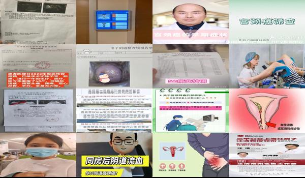 汕头做宫颈筛查流血多少天 - 汕头做宫颈筛查流血