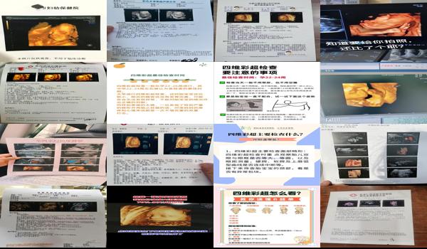 汕头37岁怀孕*要做四维吗多少钱 - 汕头37岁怀孕*要做四维吗