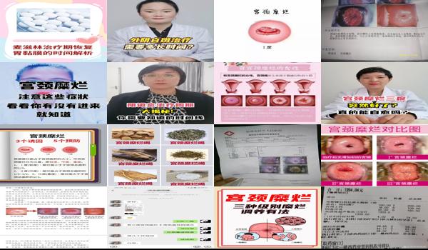宫颈糜烂三度需要多少钱 - 汕头宫颈糜烂三度需要治疗多长时间