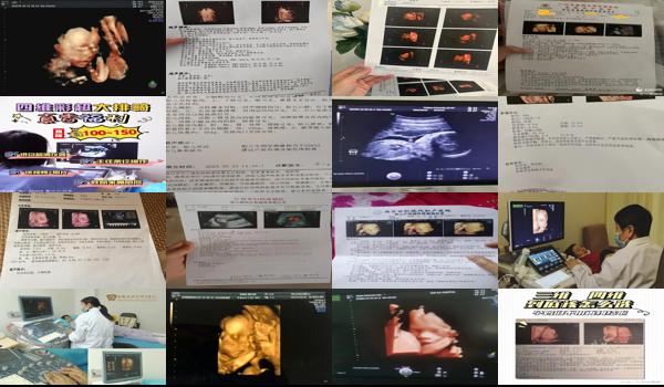 汕头做三维四维都要提前预约吗多少钱 - 汕头做三维四维都要提前预约吗