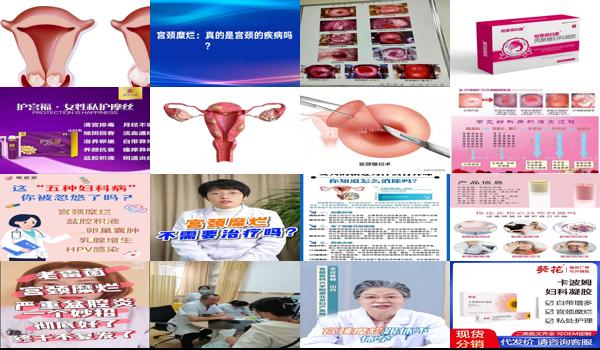护宫福能治疗宫颈糜烂吗 - 汕头,护宫富是冶妇科炎症宫颈糜烂吗