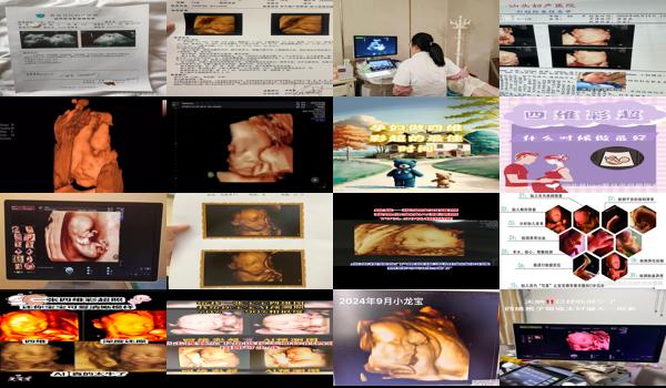 汕头怀孕多久可以做四维彩超检查 - 汕头怀孕多久可以做四维彩超