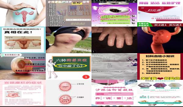 真菌感染会导致宫颈糜烂吗 - 汕头真菌感染引起宫颈糜烂