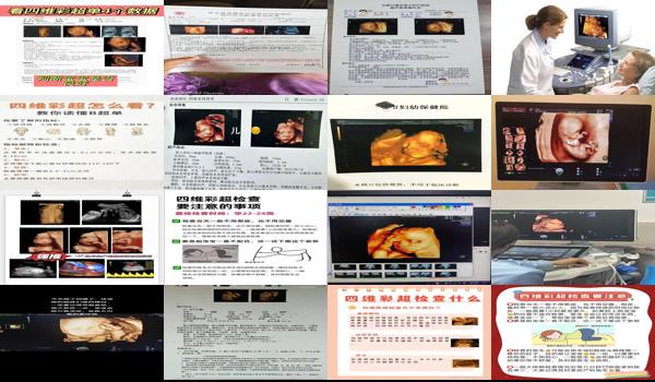 怀孕六个月做四维彩超要多少钱 - 汕头孕六个月时需要做个四维彩超产前排畸