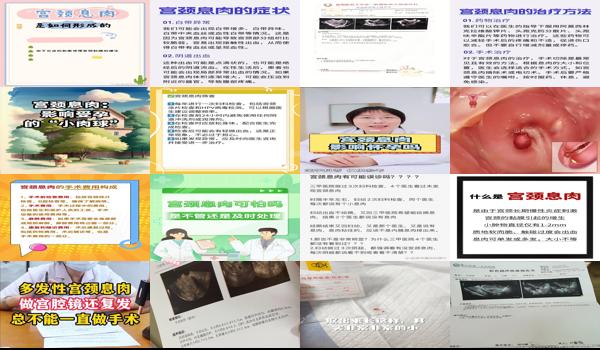 宫颈息肉能怀孕 - 汕头宫颈息肉可以怀孕吗